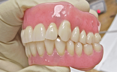 入れ歯